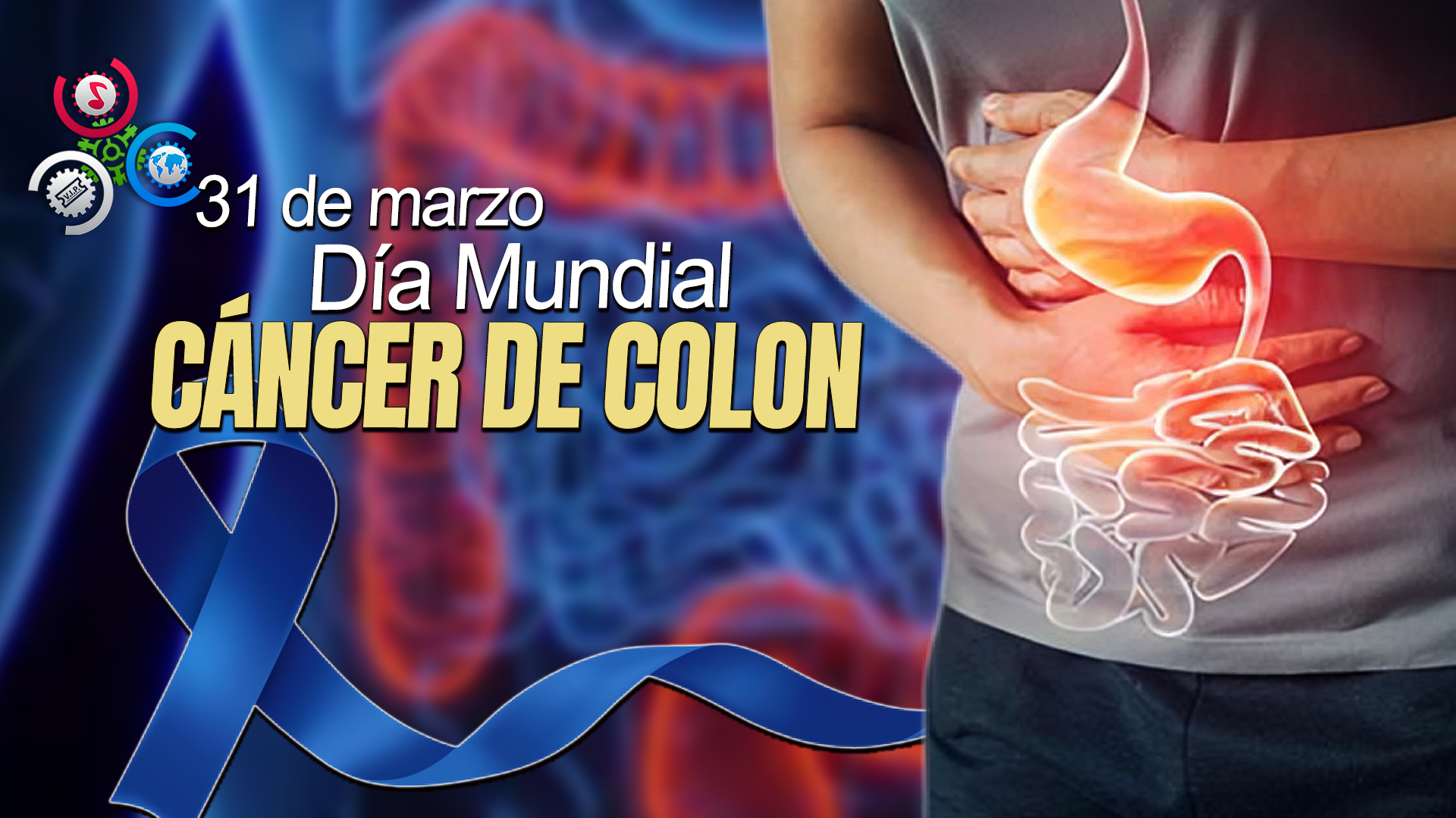 Día Mundial Contra El Cáncer De Colon: Concienciación Y Prevención