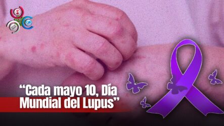 Cada 10 De Mayo Es El Día Mundial De La Concienciación Sobre El Lupus