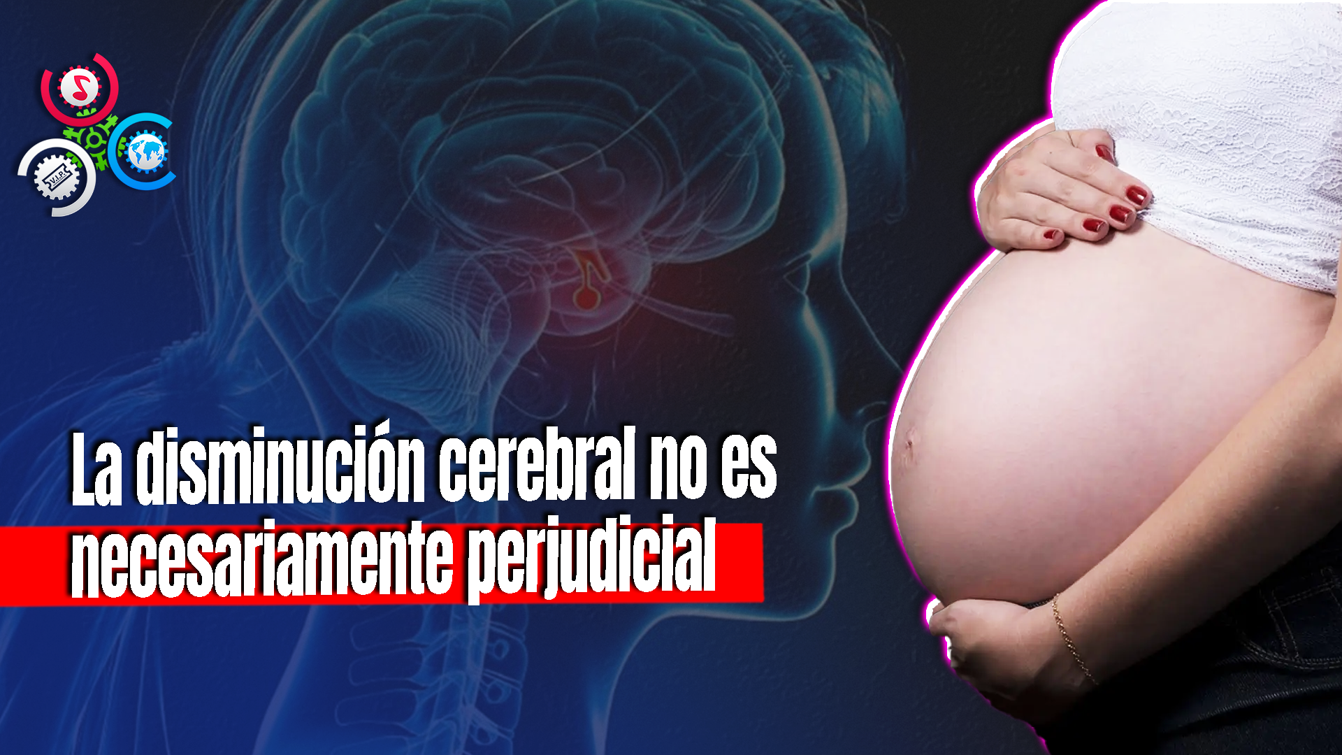 El Cerebro De La Mujer Reduce Su Tamaño Durante El Embarazo, Según Estudio