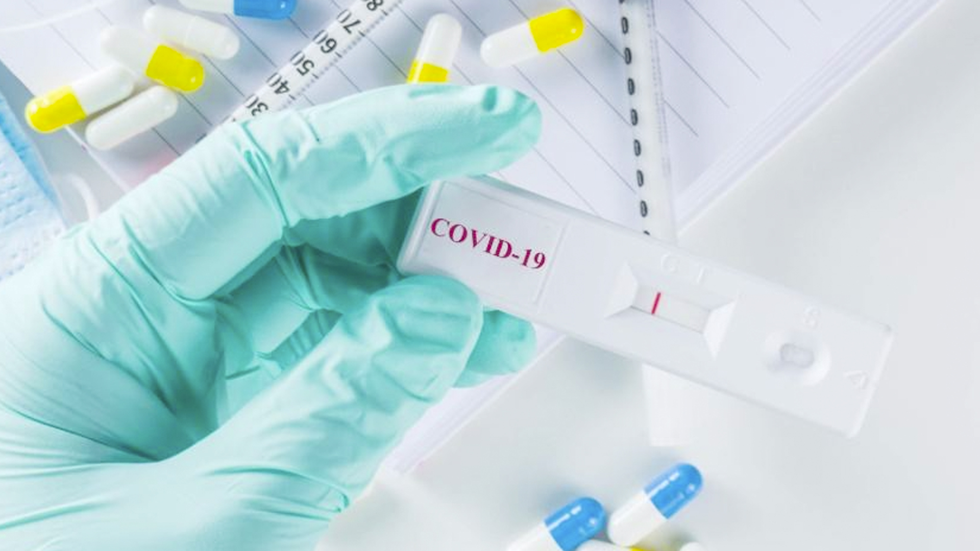 Ineficiente Gestión De Adquisición  De Pruebas