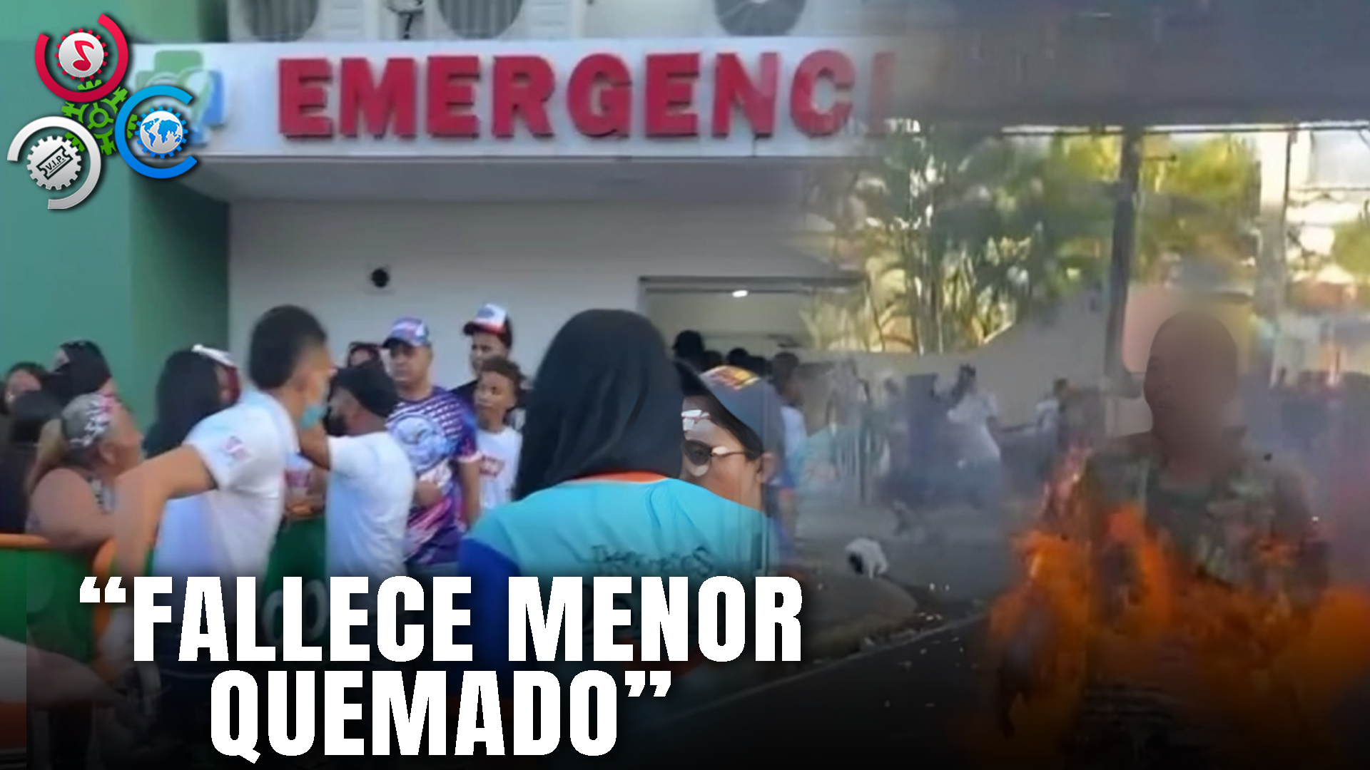 Fallece Uno De Los Adolescentes Resultaron Con Quemaduras Durante Carnaval Salcedo