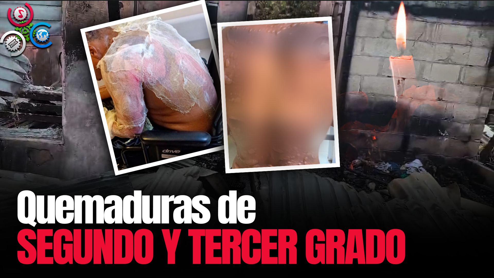 Fuego Destruye Dos Casas En El Sector Los Praditos En El Distrito Nacional