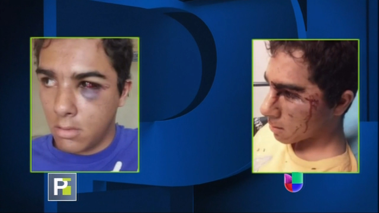 Un Joven Autista Fue Brutalmente Golpeado Por Los Policías Que Respondieron Una Llamada De Emergía En La Florida