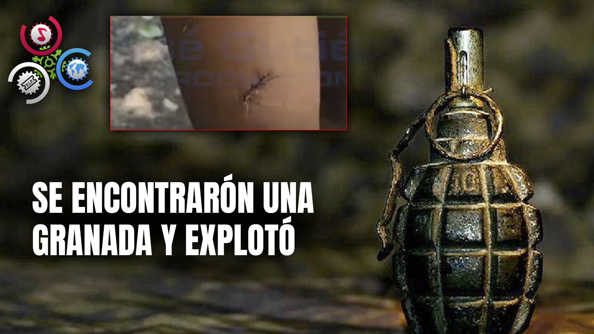 Niño Resultó Herido Tras EXPLOTAR GRANADA Mientras Jugaban En Un Patio En El Seibo