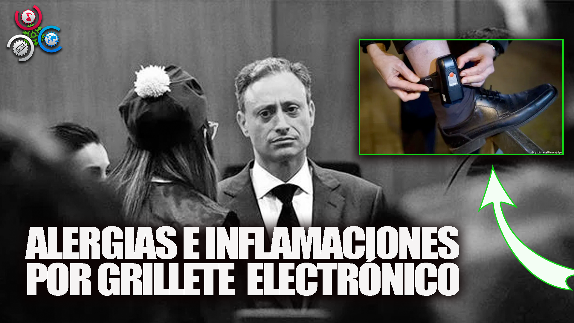 Grillete Electrónico Le Provoca Alergias A Jean Alain Rodríguez