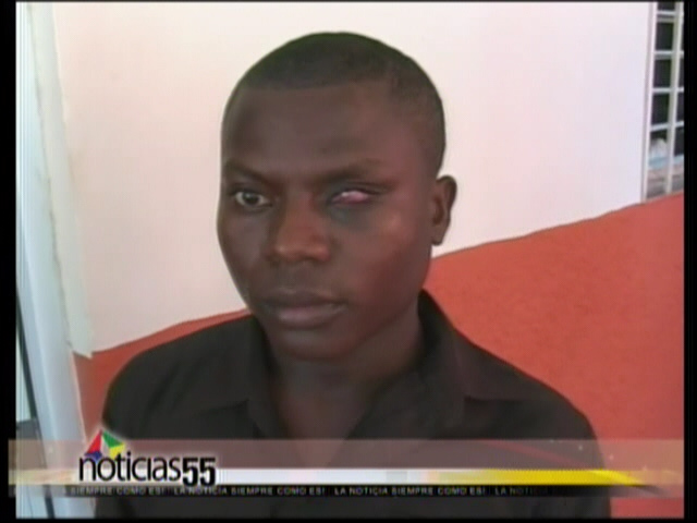 Haitiano Denuncia Maltrato De Policía Que Le Hizo Perder La Vista De Un Ojo