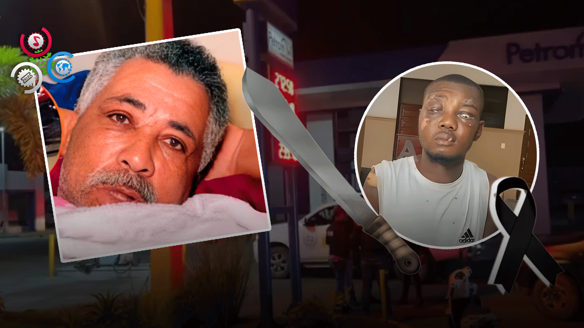 Fallece Haitiano Que Agredió Un Vigilante A Machetazos En SFM