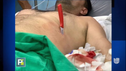 Hombre Conduce Con Un Puñal Clavado En Su Abdomen Hasta Un Hospital Luego  De Ser Atracado
