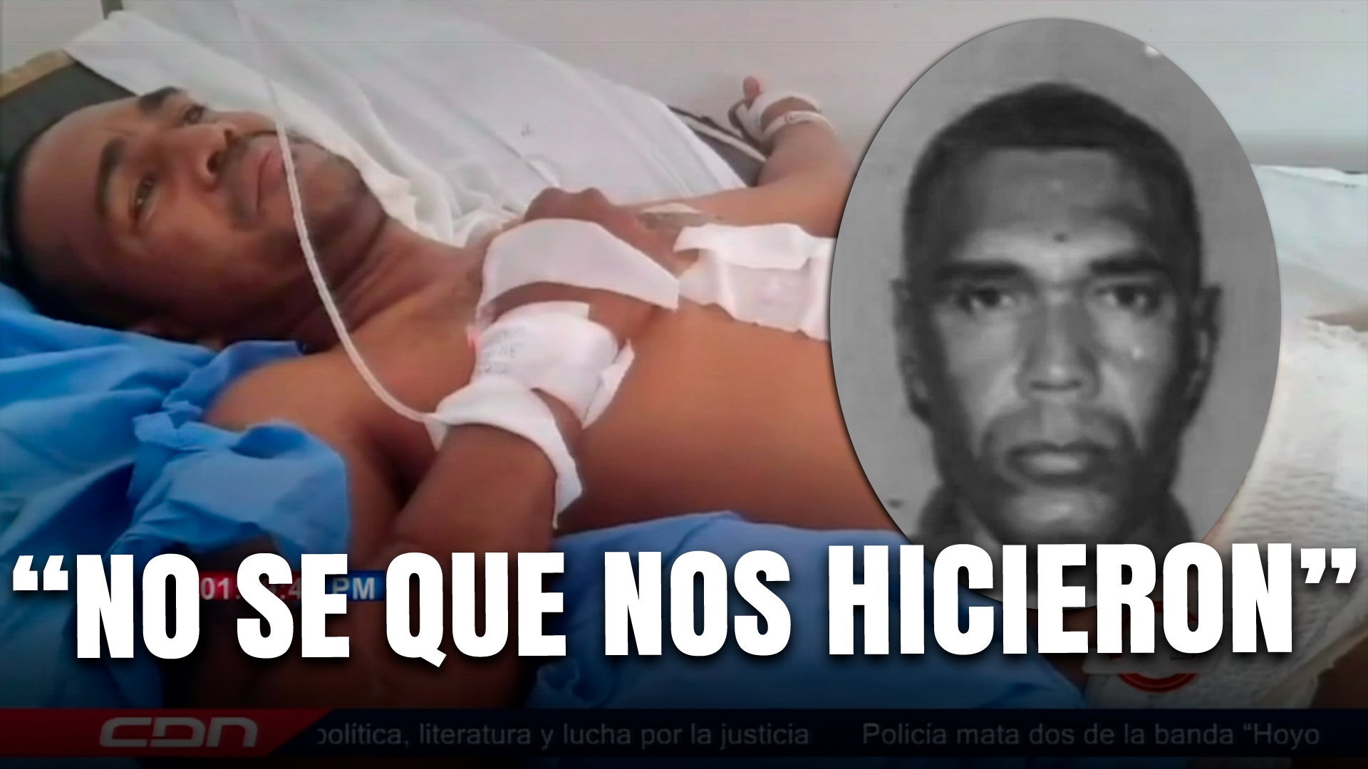 Herido En Enfrentamiento Entre Hermanos Habla Sobre El Hecho