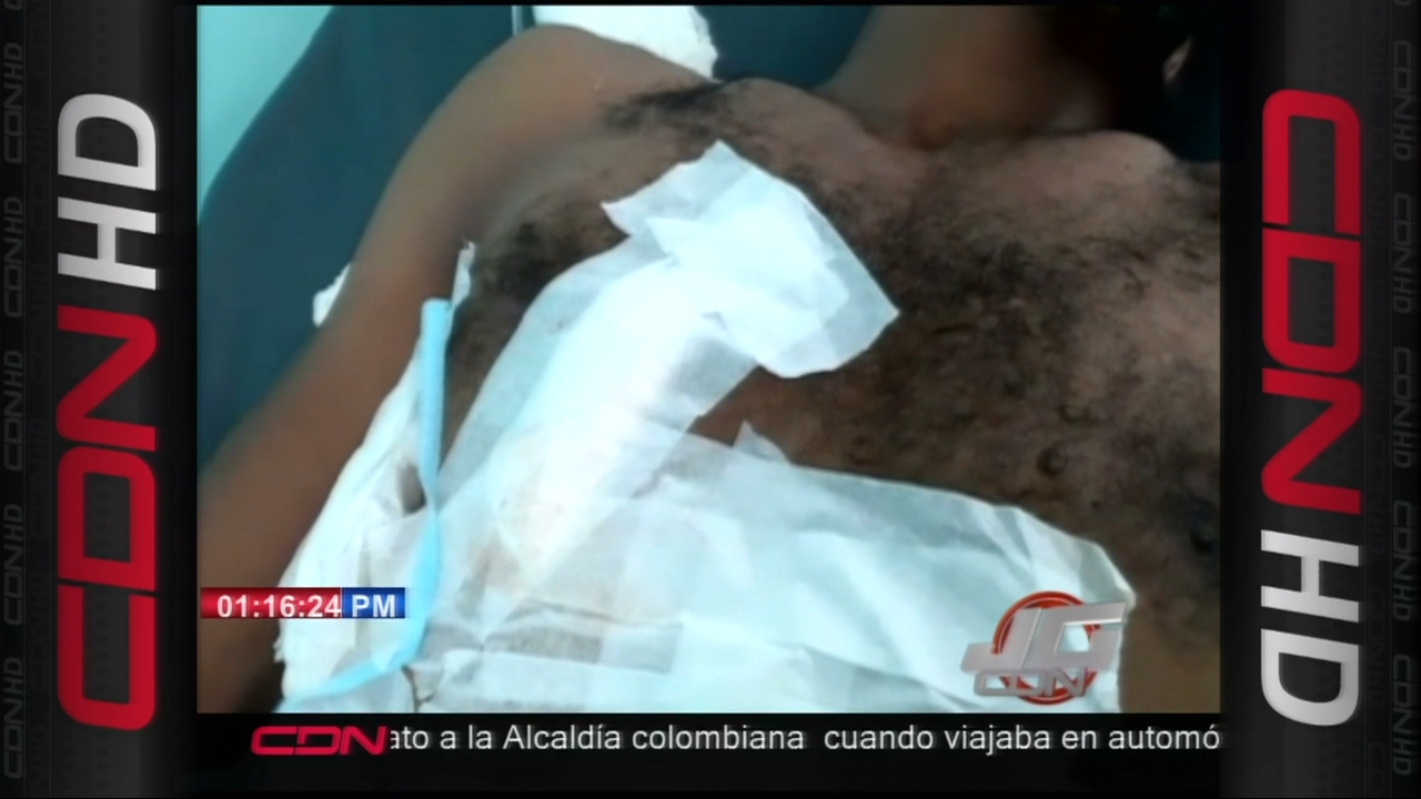 Miembros De La Policía Hiere A Un Ciudadano En San Pedro