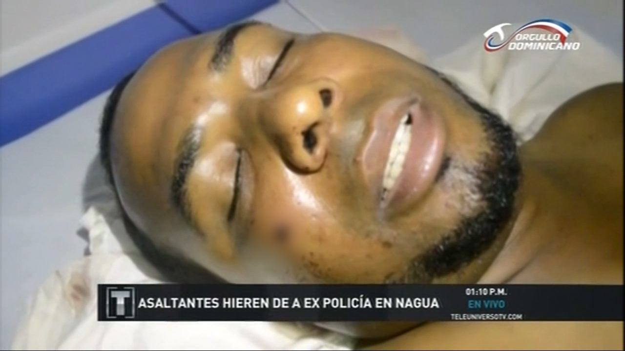 Hieren Con Disparo En La Cabeza A Ex Policía En Nagua