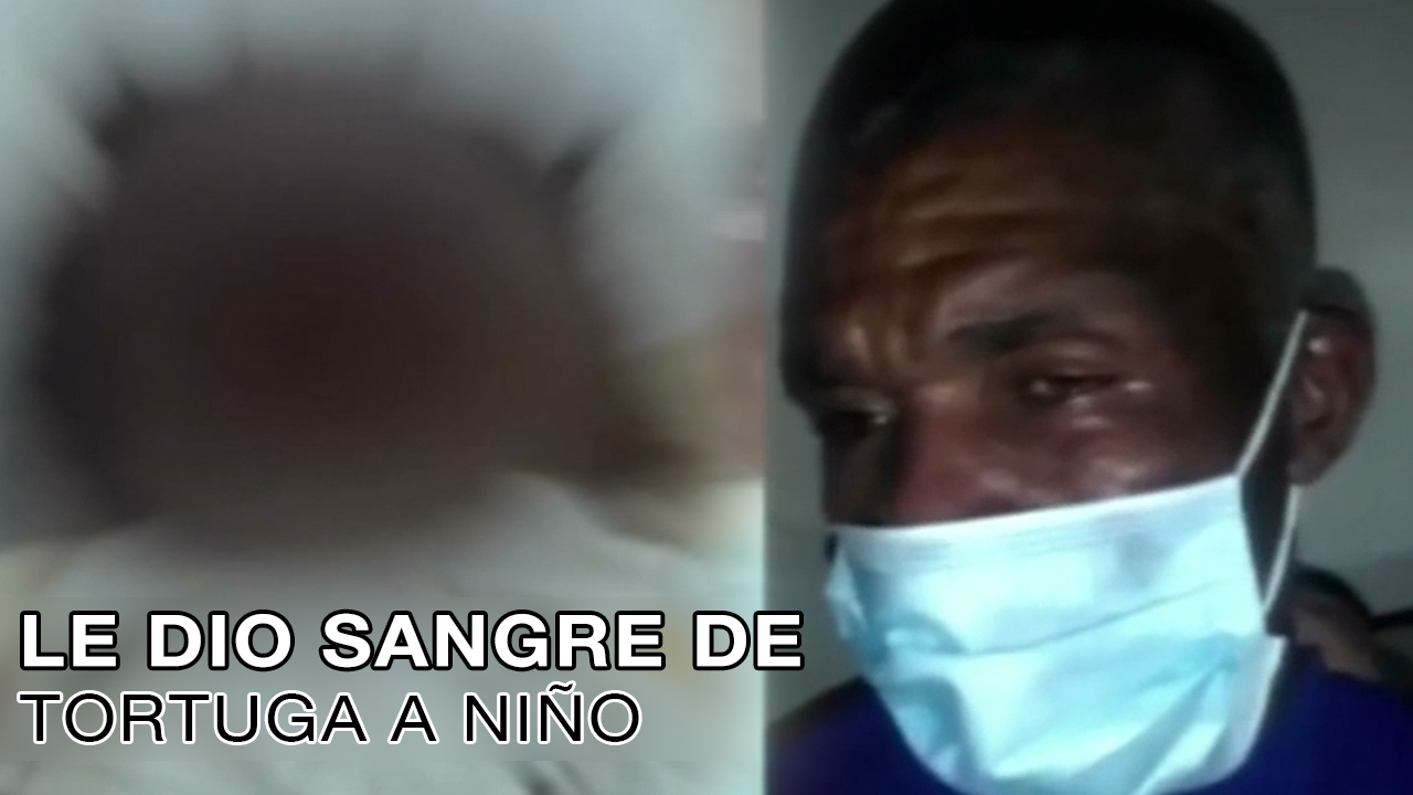 Tres Meses De Prisión Haitiano Que Le Dio Sangre De Tortuga A Niño 