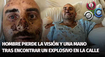 Hombre Pierde La Visión Y Una Mano Tras Encontrar Un Explosivo En La Calle