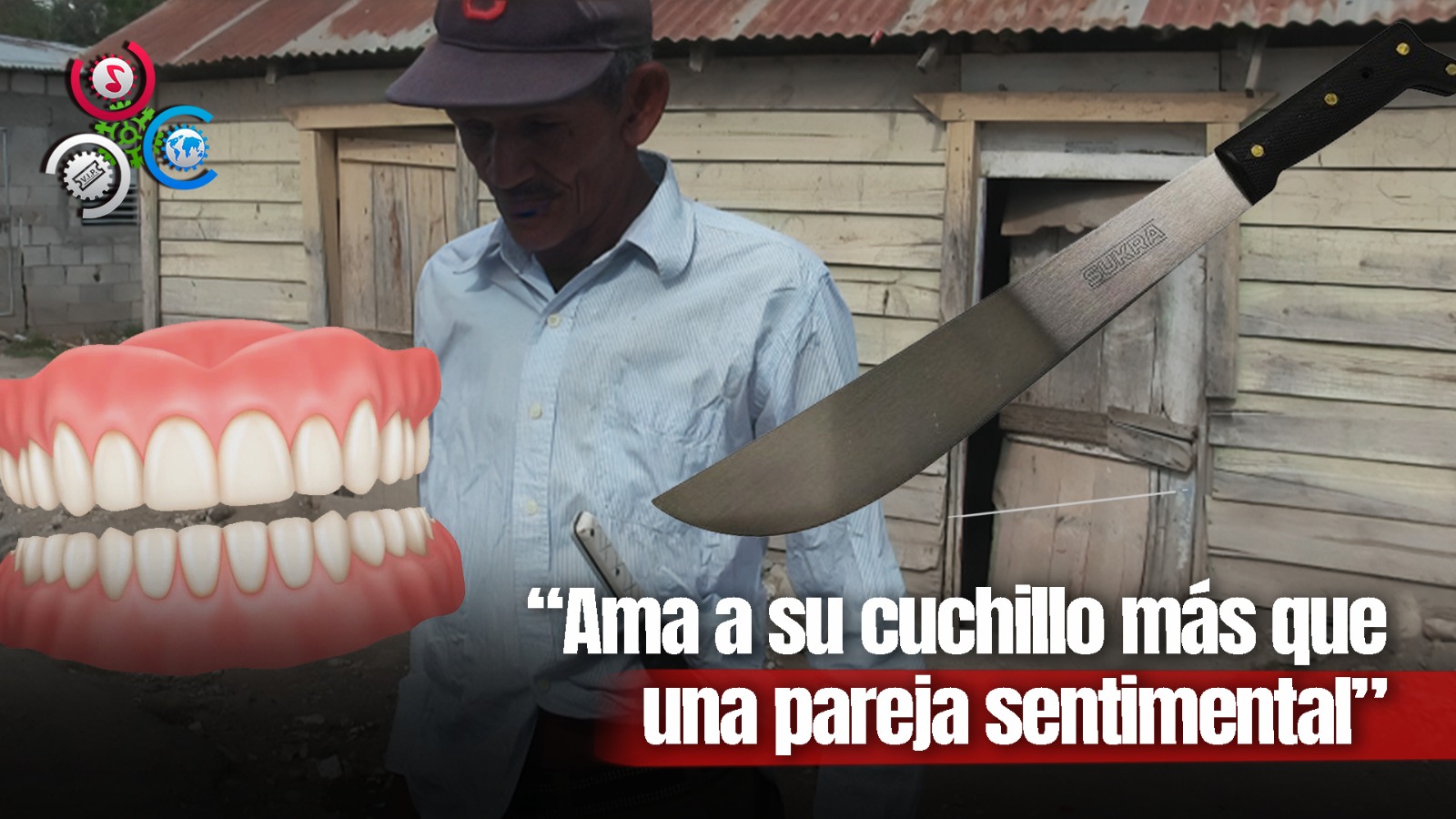 Hombre Relata Usa Su Cuchillo Como Dentadura Toda Su Vida Tras Perder Sus Dientes