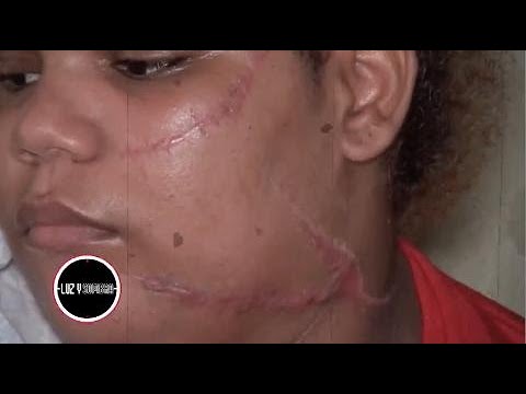 3 Mujeres Le DESFIGURAN EL ROSTRO A Otra De 15 Años Supuestamente Por Esto