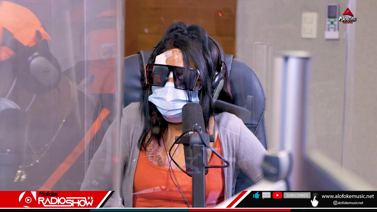 ¡FUERTES DECLARACIONES DE LA JOVEN ROCIADA CON ÁCIDO – MI HIJA LO PRIMERO QUE DIJO ES QUE YO ERA UN CUCO!!!