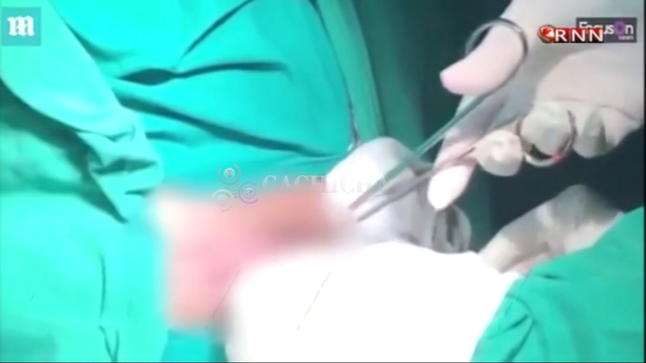 Mujer Transgénero, Primera En Recibir Implante De Vagina Hecha Con Piel De Pescado