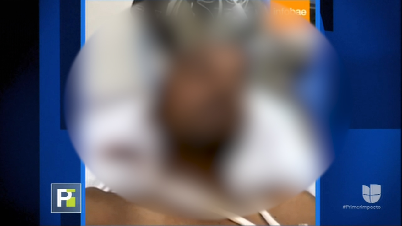 ¡IMÁGENES FUERTES! Con Una Barra De Hierro En La Cabeza Terminó Un Joven En La India