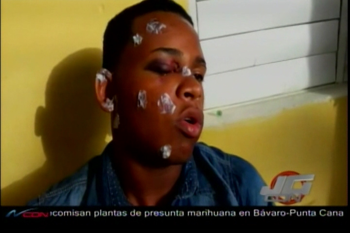 En Villa Gonzalez Denuncian Maltrato A Un Joven Por Parte De La Policía
