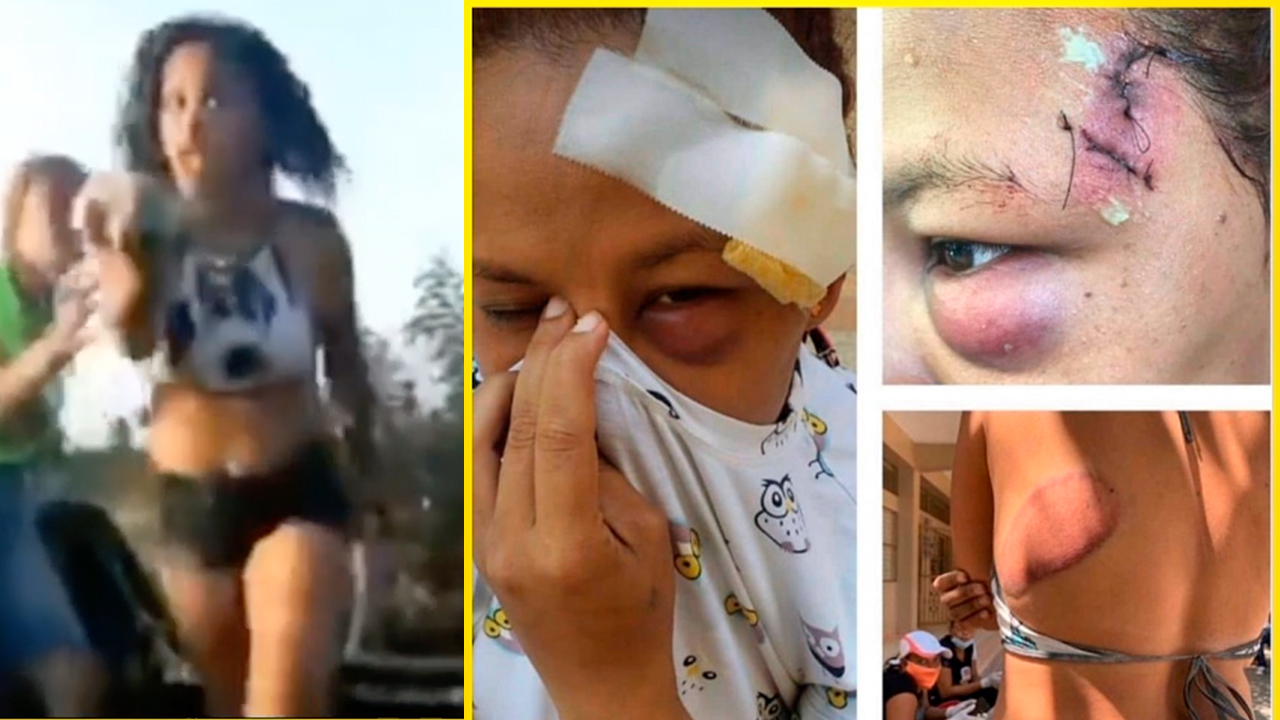 De Esta Manera Quedó La Joven Que Agredió Policía A Pedradas