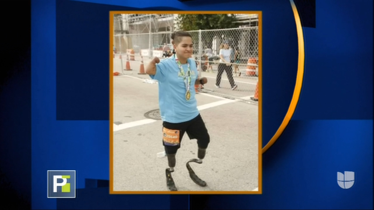 Joven Sale De Vacaciones Con Su Familia Y Pierde Sus Extremidades Por Culpa De Una Bacteria