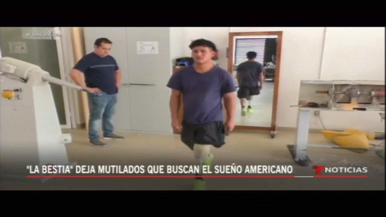 “La Bestia” Deja Mutilados Que Buscan El Sueño Americano.