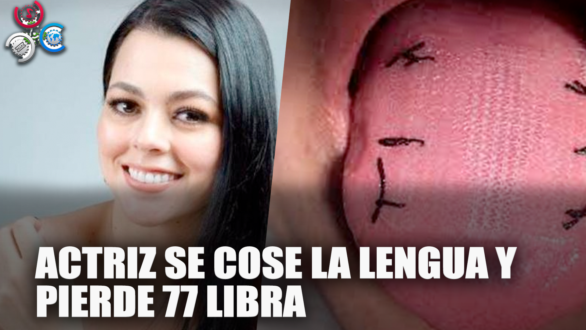 Actriz Se COSE LA LENGUA Y Queda Irreconocible Tras Bajar 77 Libras