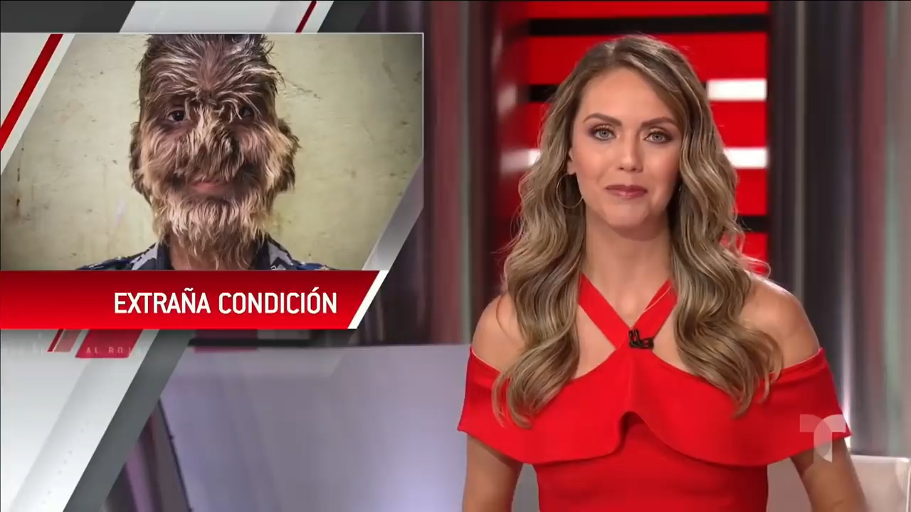 La INSPIRADORA Historia Del Niño Lobo