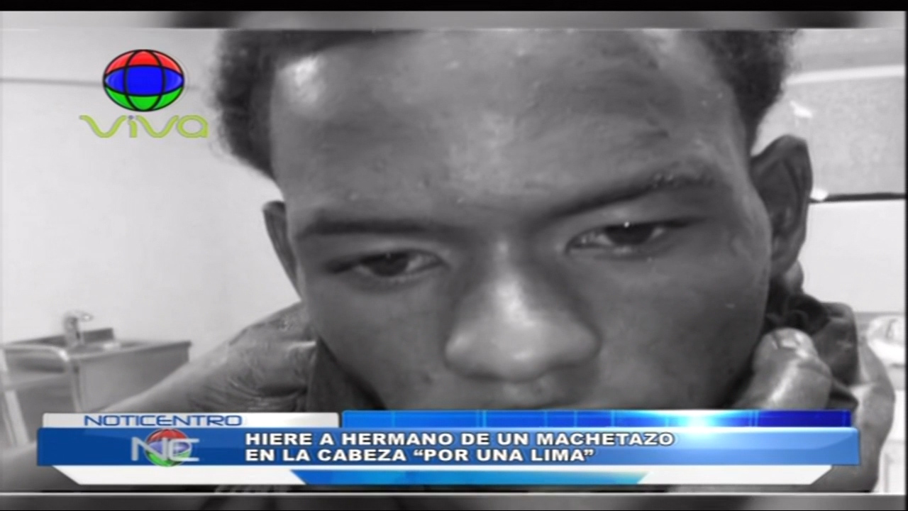 Hiere A Hermano De Un Machetazo En La Cabeza “Por Una Lima”