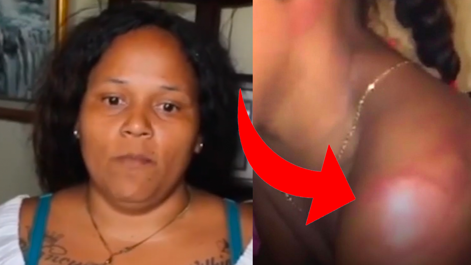 Madre De Niña Golpeada Por Su Tía Da La Cara Y Dice Esto