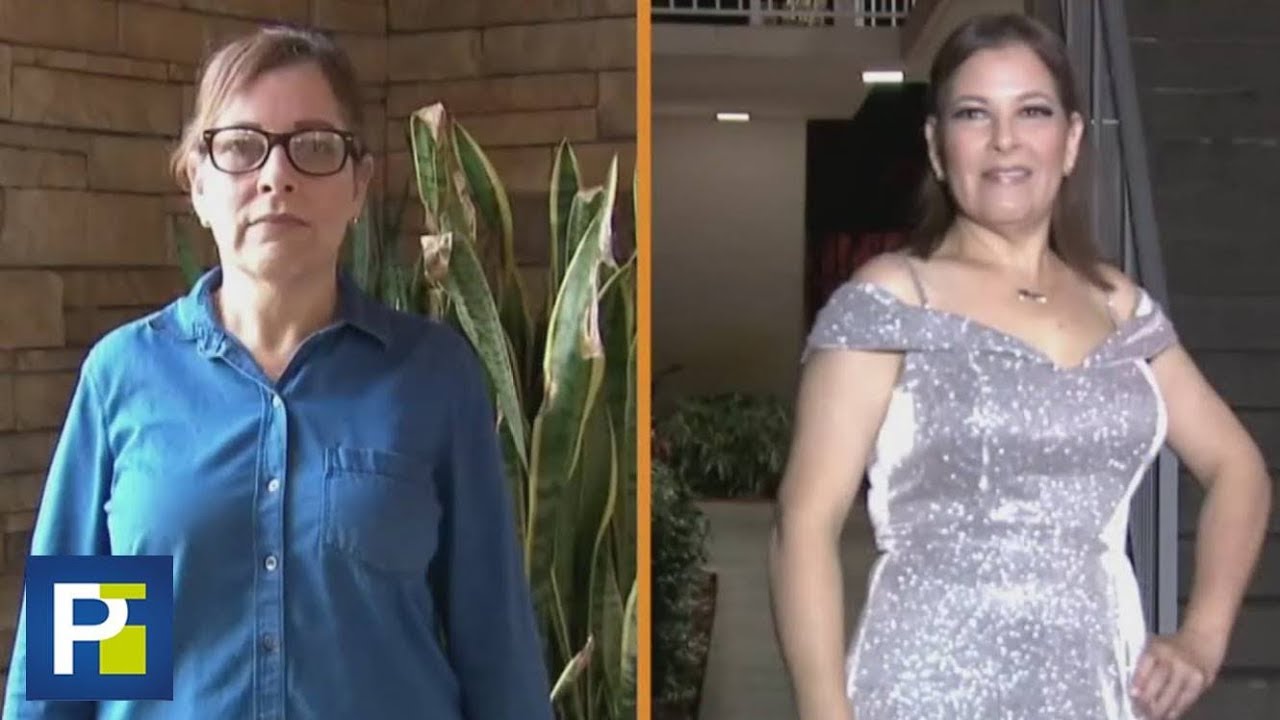 El Antes Y El Después De Una Sesión De Belleza A Una Madre Que Sufrió Tres Parálisis En El Rostro