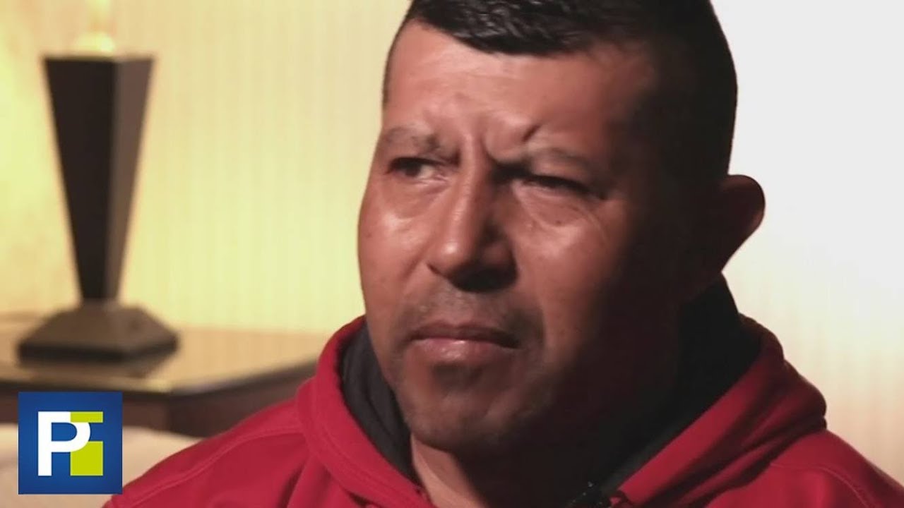 Pensaba Que Sufría De Migrañas, Pero En Realidad Tenía Un Gusano En Su Cerebro