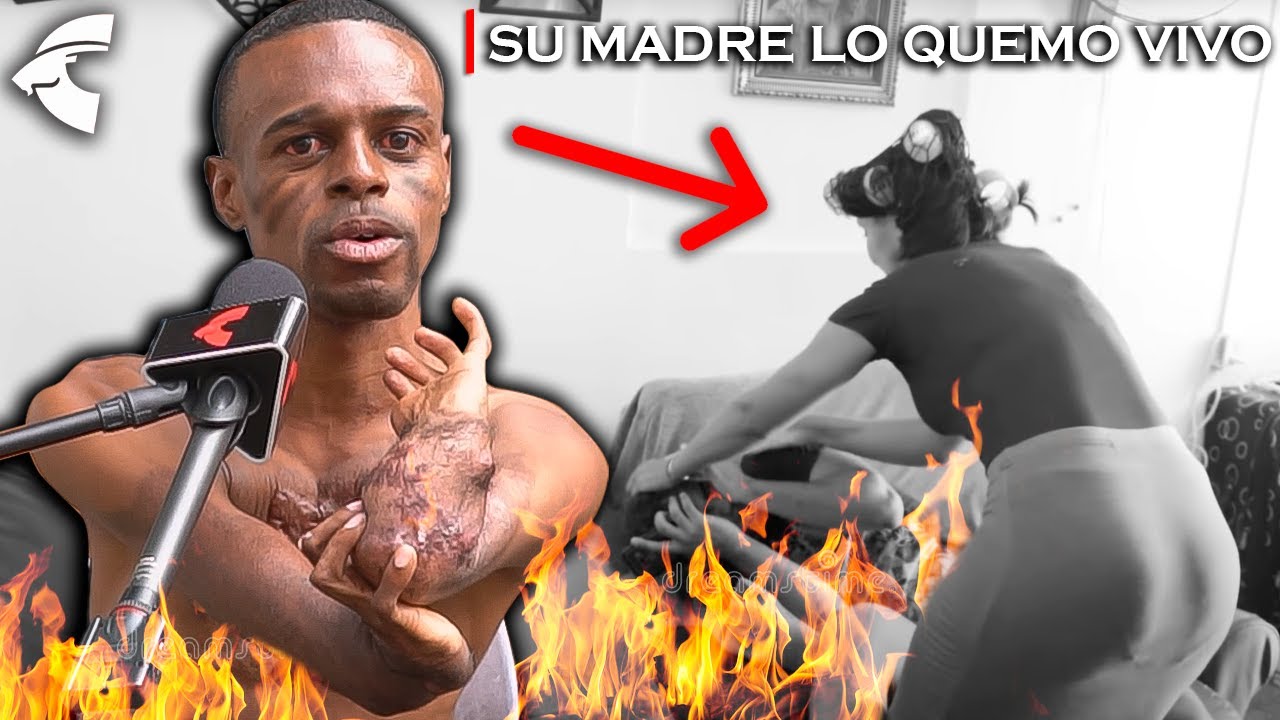 MI MADRE ME PRENDIÓ EN FUEGO POR ESTO | Increíble Historia 