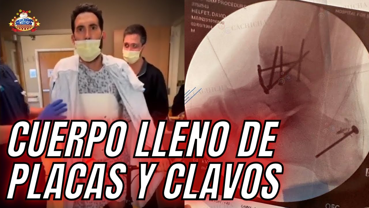 Karim Muestra Múltiples Cirugías Luego De Sobrevivir A Accidente 