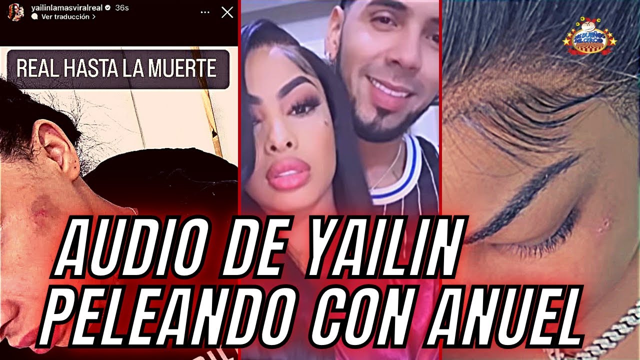 Dique Golpe De Yailin Es Cicatriz De Piercing | ¿Yailin Mintió O Fue Anuel?