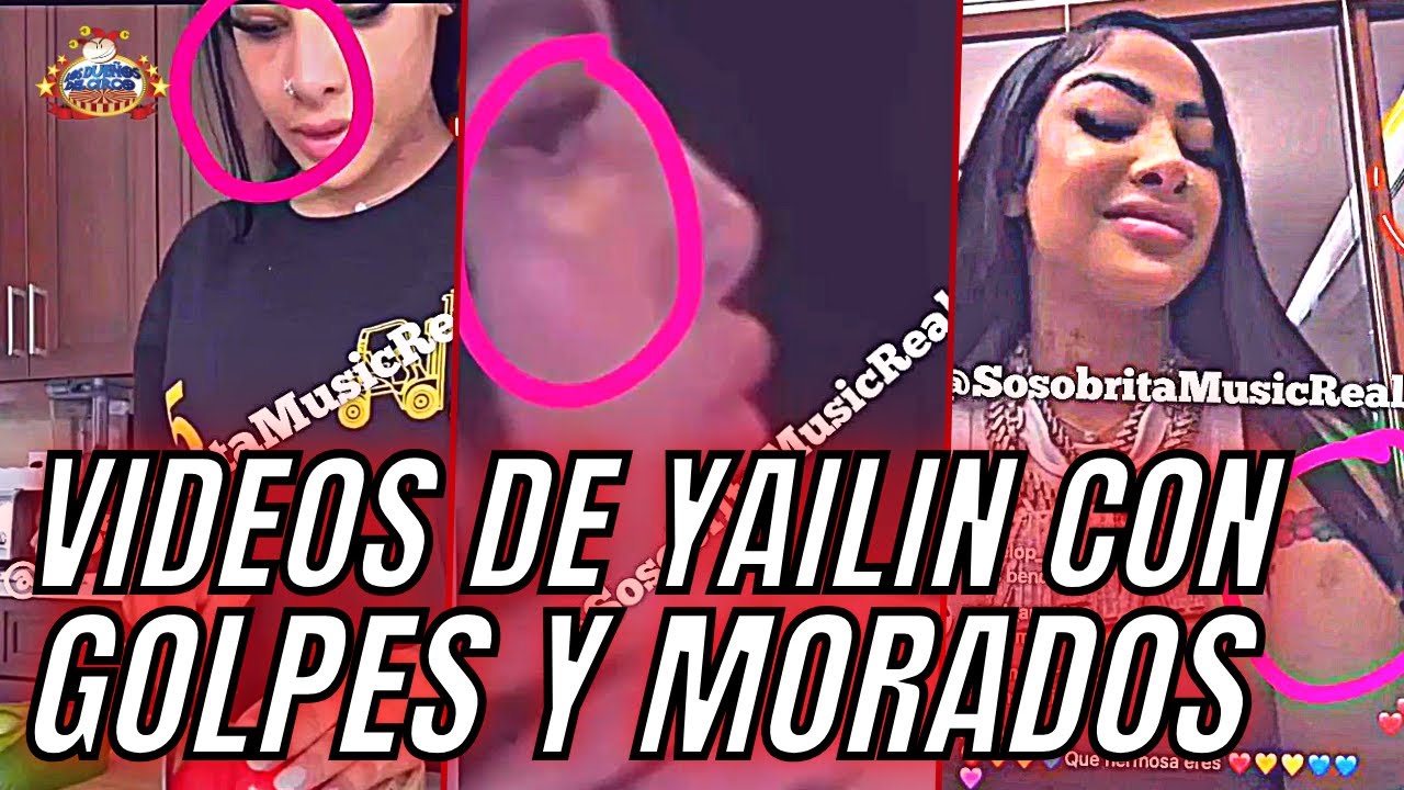 Videos De Yailin Con Golpes Y Morados | Jenn Y Shadow Se Burlan De Yailin
