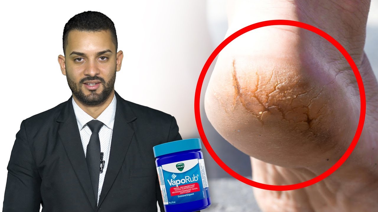 5 USOS ALTERNATIVOS DEL VICKS VAPORUB | Disfrutar Aprendiendo