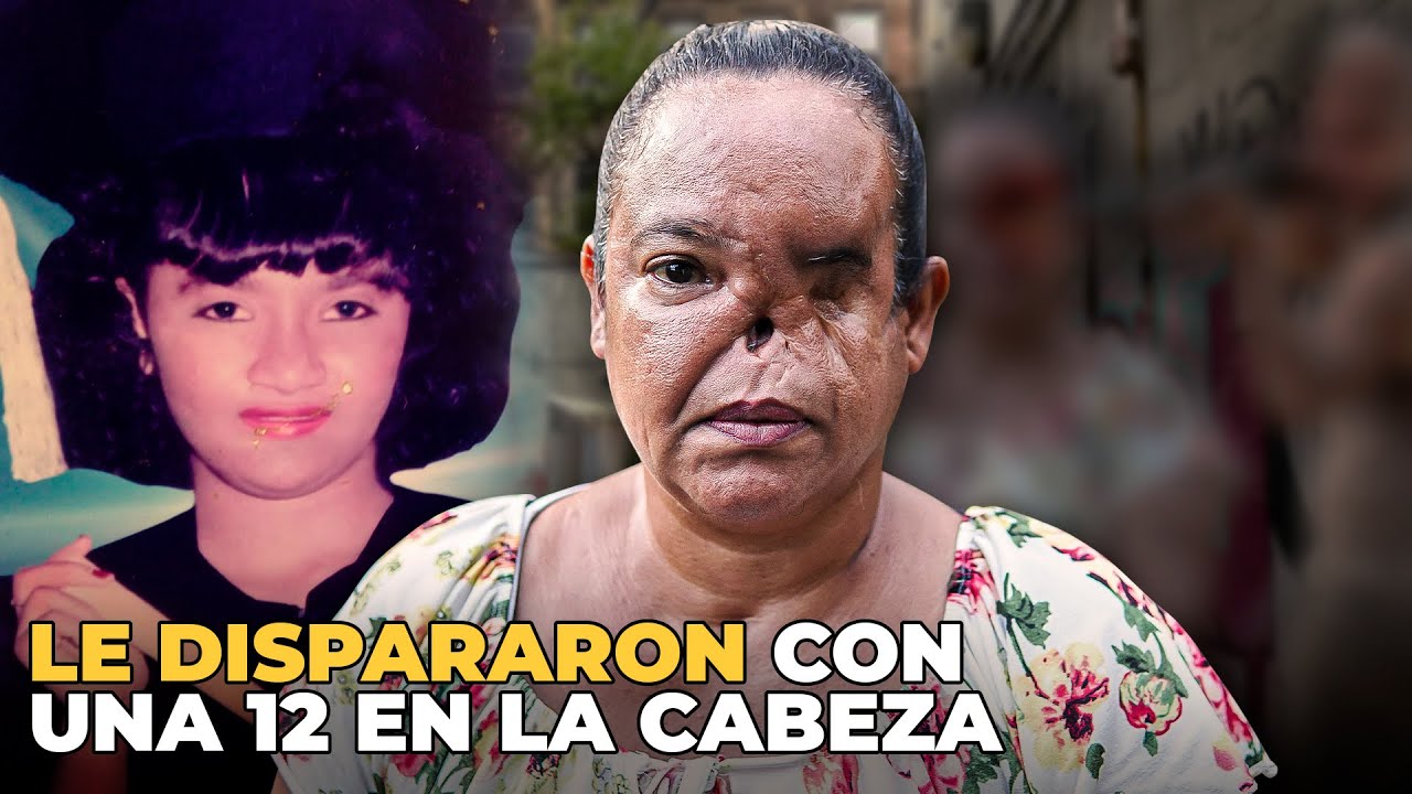 ME DIO CON UNA ESCOPETA EN EL ROSTRO Y LUEGO NOS CASAMOS