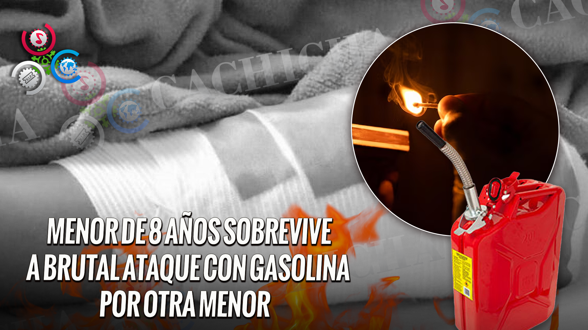 Niña De 8 Años Quemada Con Gasolina Por Otra Menor De 14, Permanece Estable
