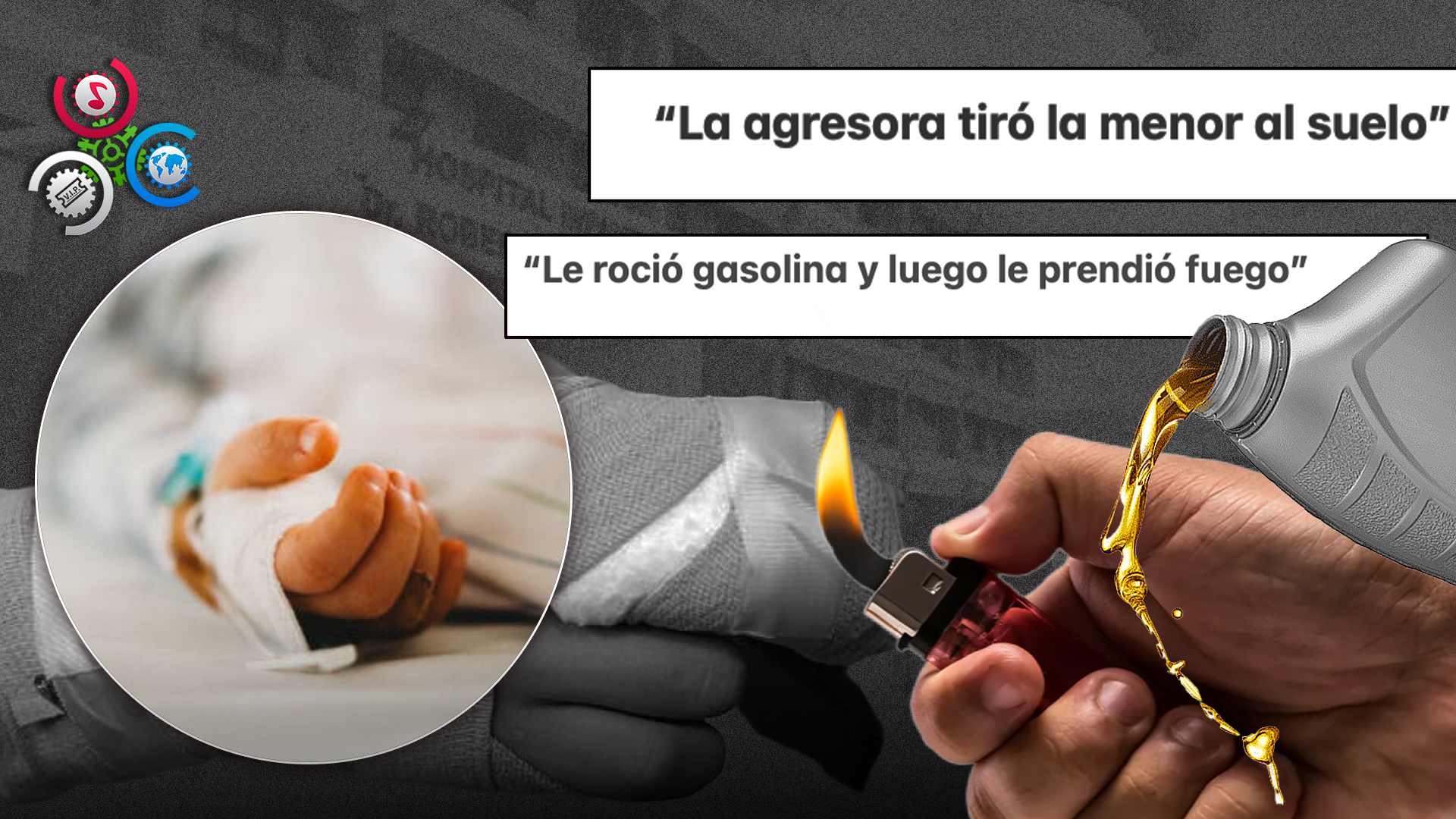 Menor De 8 Años Sufre Quemaduras Graves De Otra Menor En Santo Domingo Este