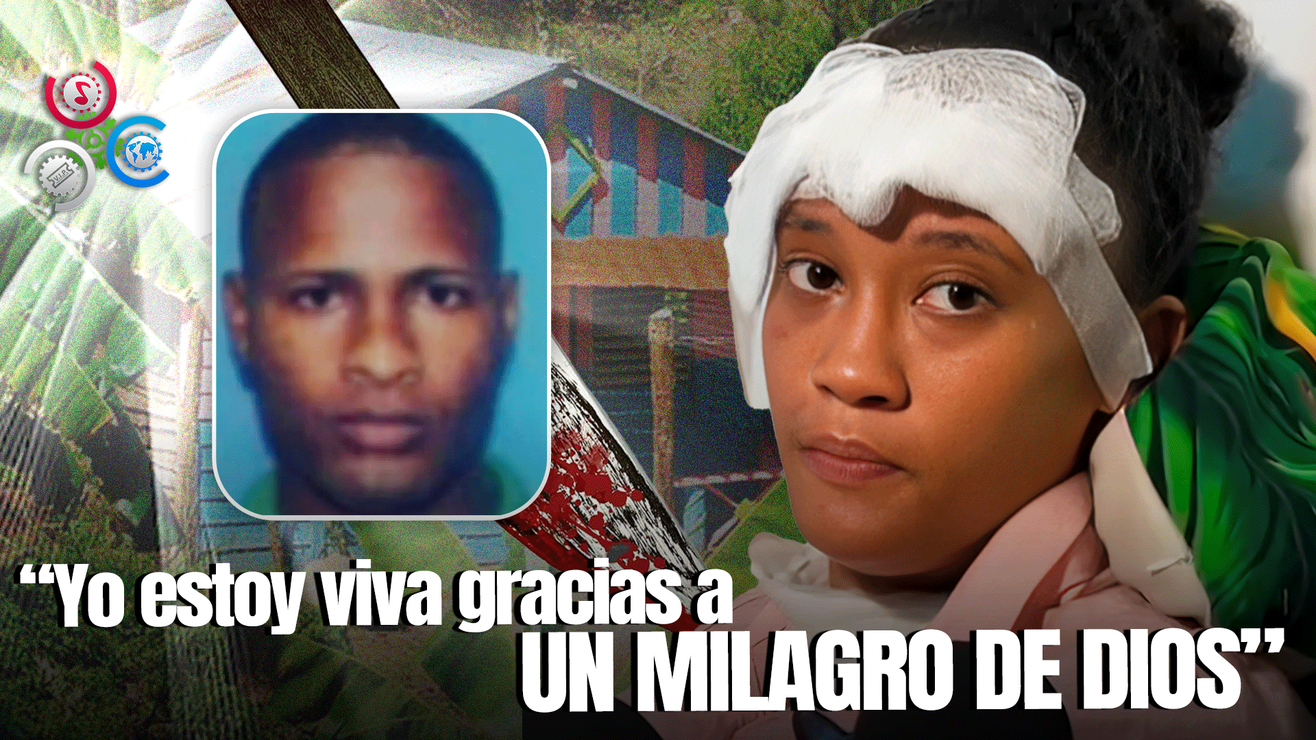 Mujer Herida Por Su Expareja En Monte Plata Relata Cómo Sobrevivió Al Brutal Ataque