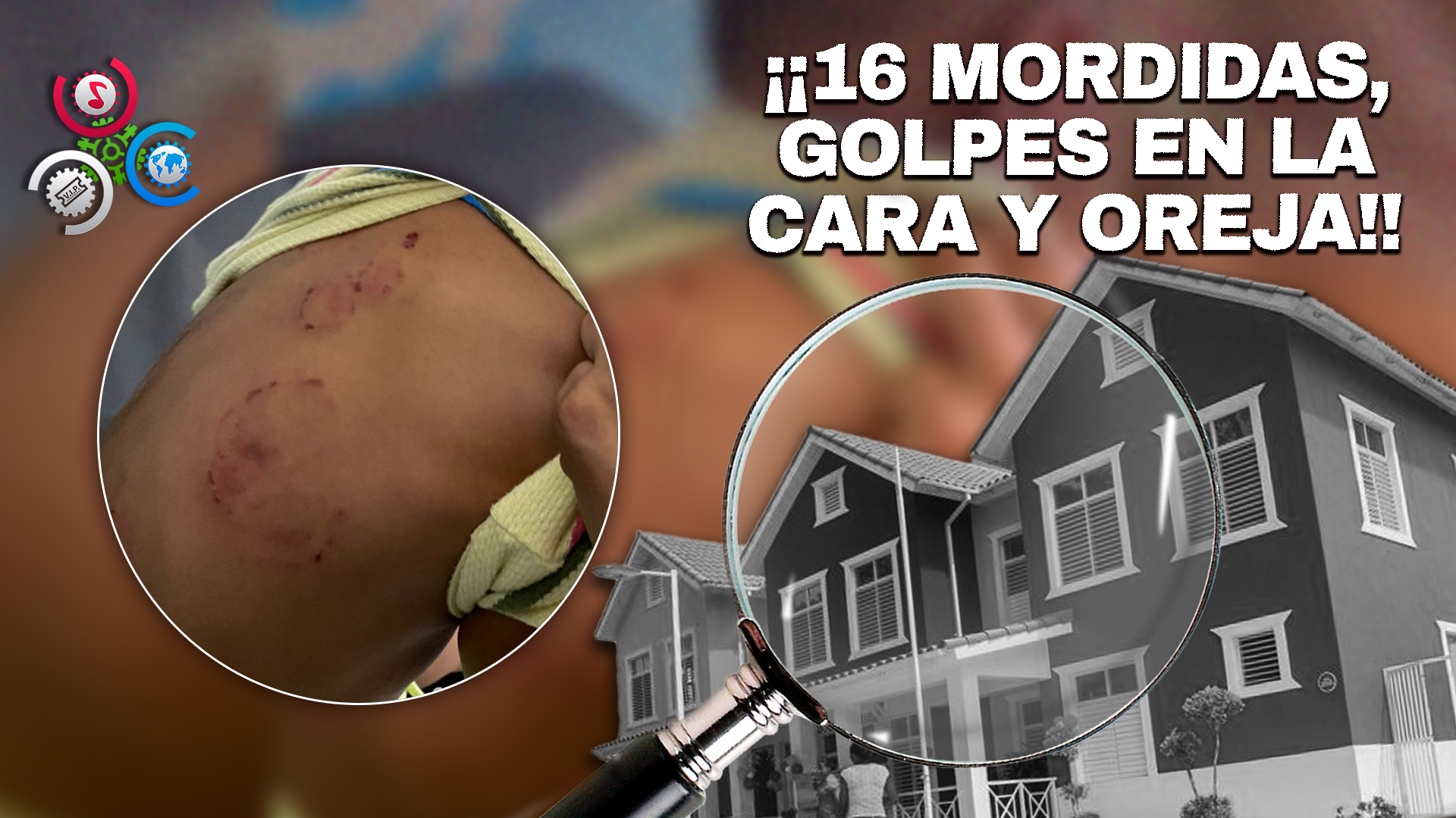 Madre Denuncia Agresión Salvaje A Niño Supuestamente En El CAIPI