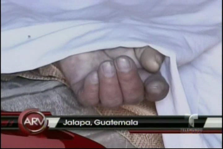 Tragedia En Motel: Muere Hombre En Pleno Acto De Amor