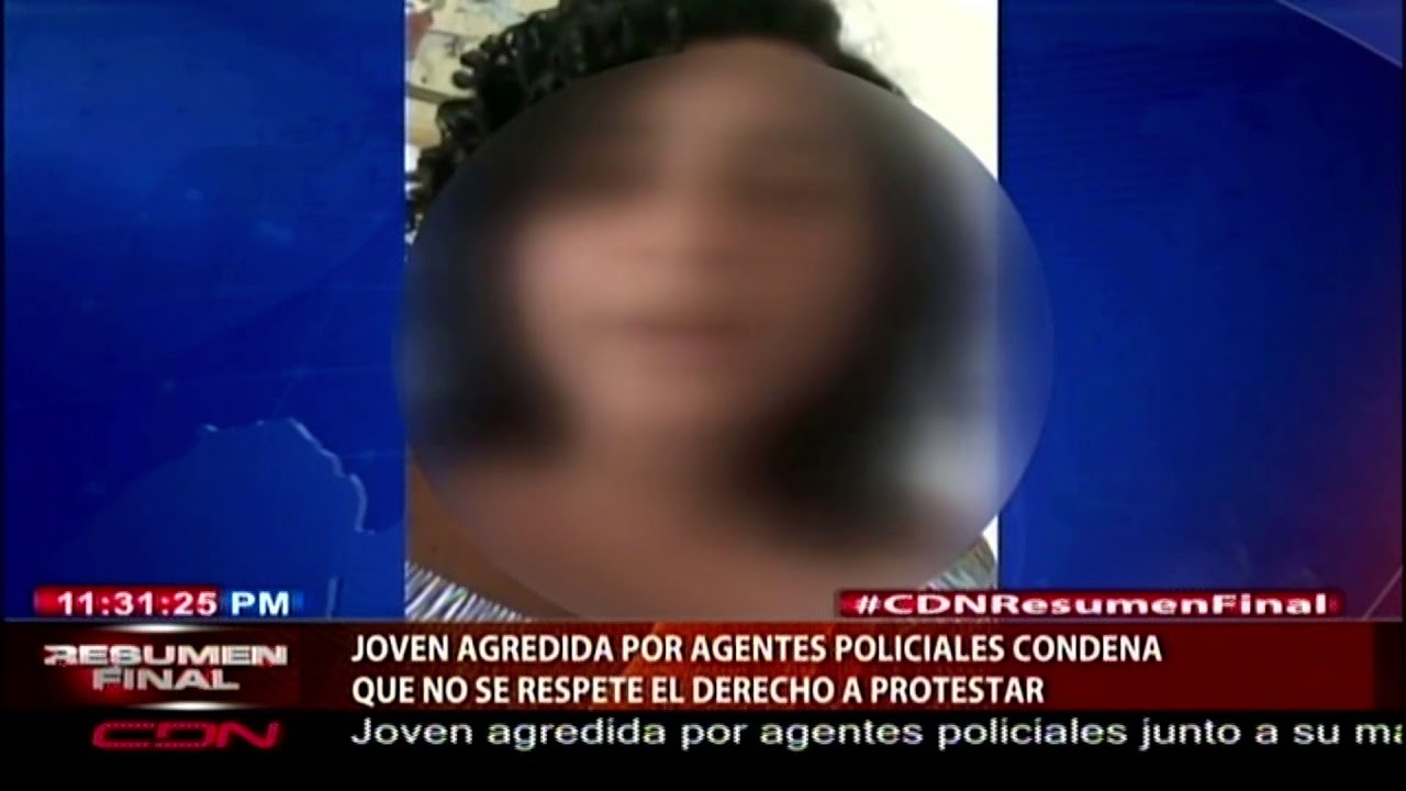 Joven Agredida Por Agentes Policiales Condena Que No Se Respete El Derecho A Protestar