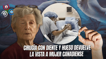 Mujer Ciega Durante Diez Años Recupera La Vista Gracias A Cirugía Con Diente En El Ojo