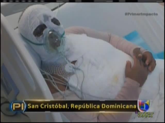 Mujer Rocia A Otra Con Acido Del Diablo En San Cristóbal #Video