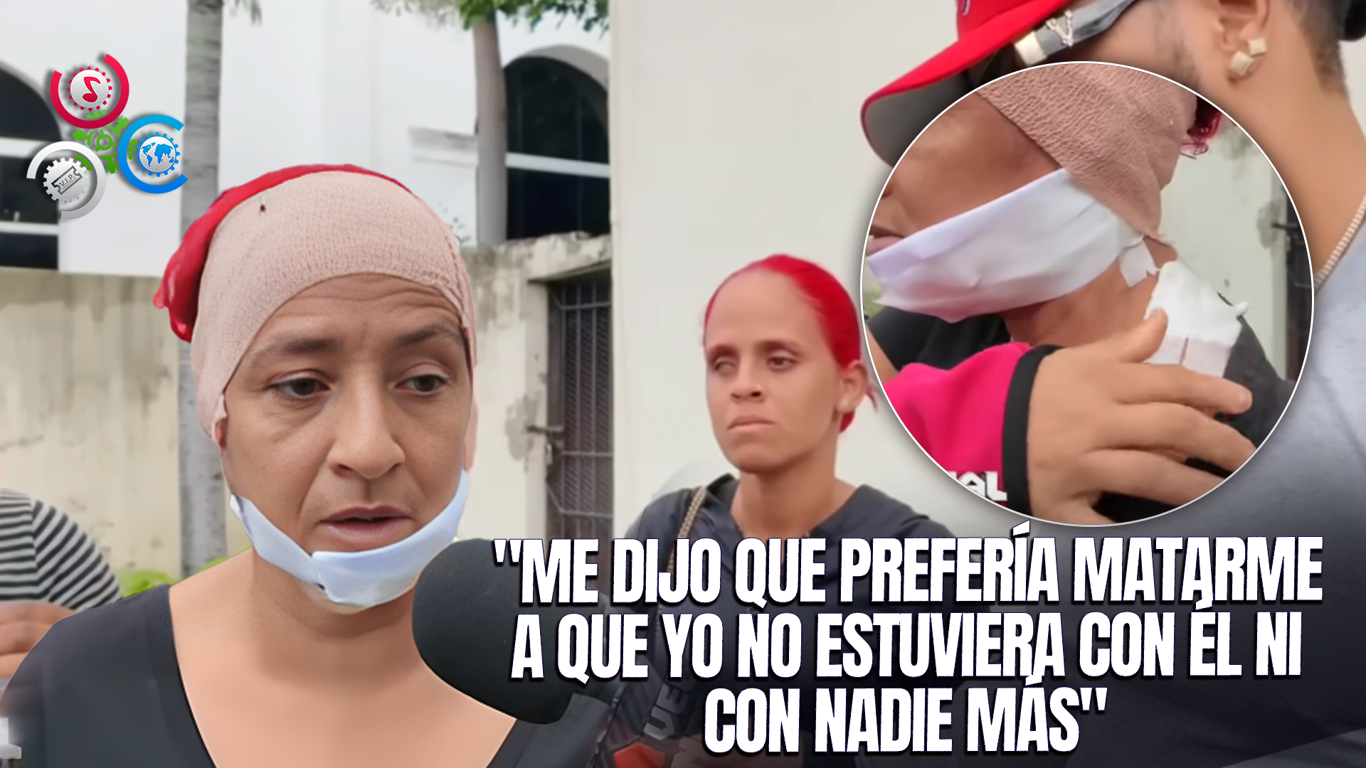 Mujer Denuncia Brutal Ataque De Su Expareja Que Casi Le Corta La Cabeza En La Vega