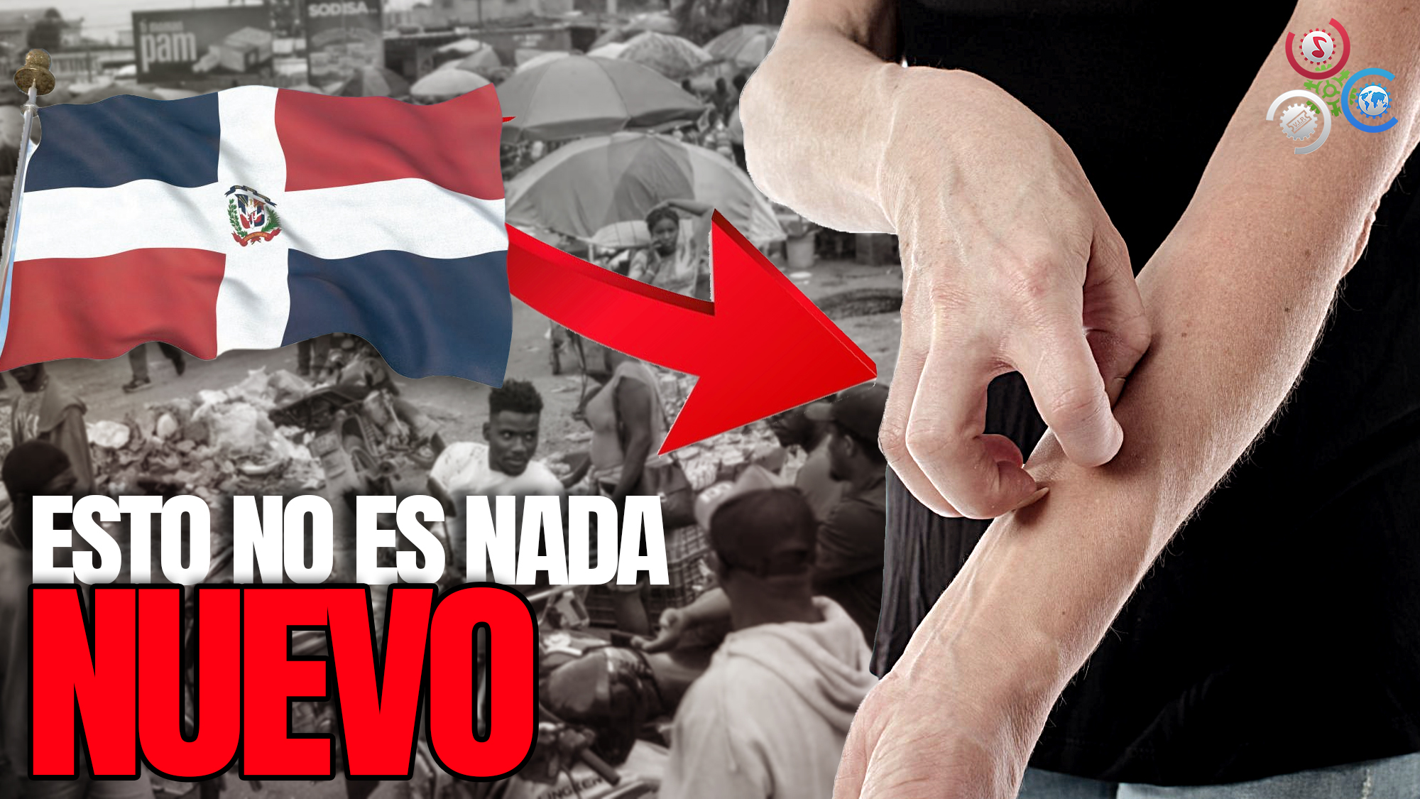 Experta En Dermatología Dice “RD Y Haití Conviven Con La Sarna Humana Permanentemente”