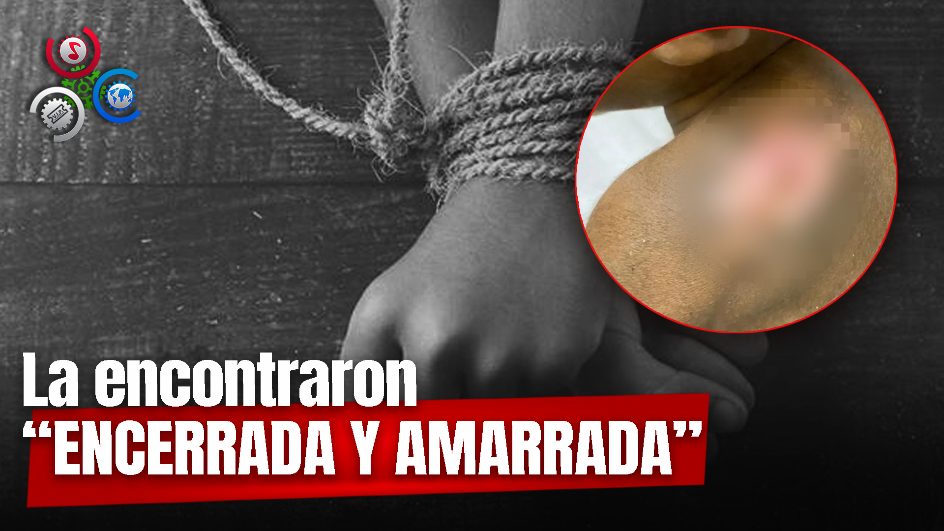 PN Rescata Niña Que Era Brutalmente Maltratada En Barahona
