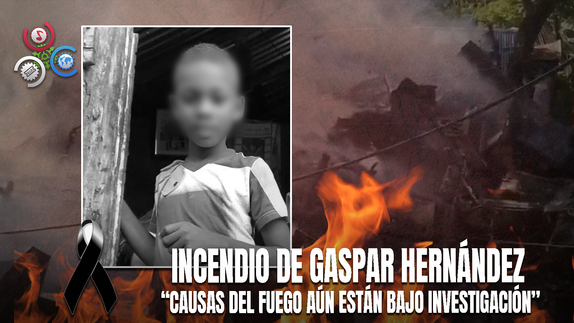 Joven Cubano Lucha Contra Parásito Que Invadió Su Pierna Y La Música  Ha Sido Su Mejor Aliado